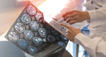 Bulanık Görme ve Güçsüzlük MS Belirtisi Olabilir