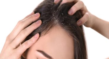 Sedef hastalığı neden olur?