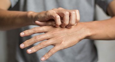 Uyuz vakalarında artış !