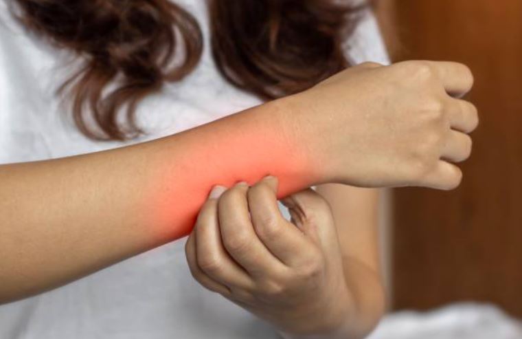 Uyuz Hastalığı Nedir? Uyuz Hastalığı Neden Olur?