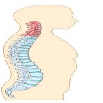 Boyun Fıtığı ve Ameliyat Yöntemleri: ACDF ve PCF Karşılaştırması